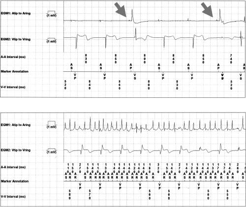 figure2